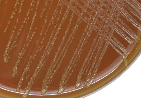 PRESENTATION ON THE IDENTIFICATION OF NEISSERIA GONORRHOEAE IN MEDICAL LABORATORIES